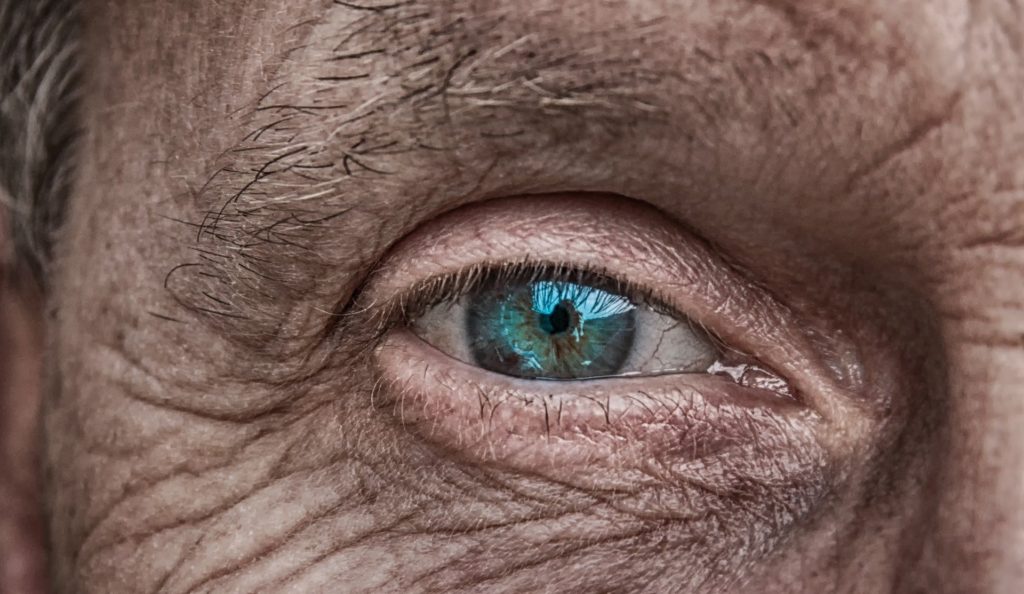 Eyelid Lift in Huntington, NY