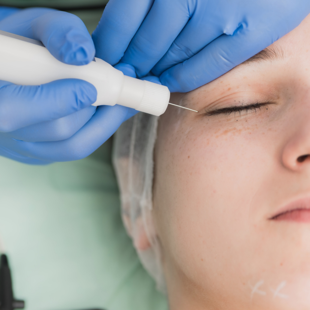 Eyelid Lift in Huntington, NY