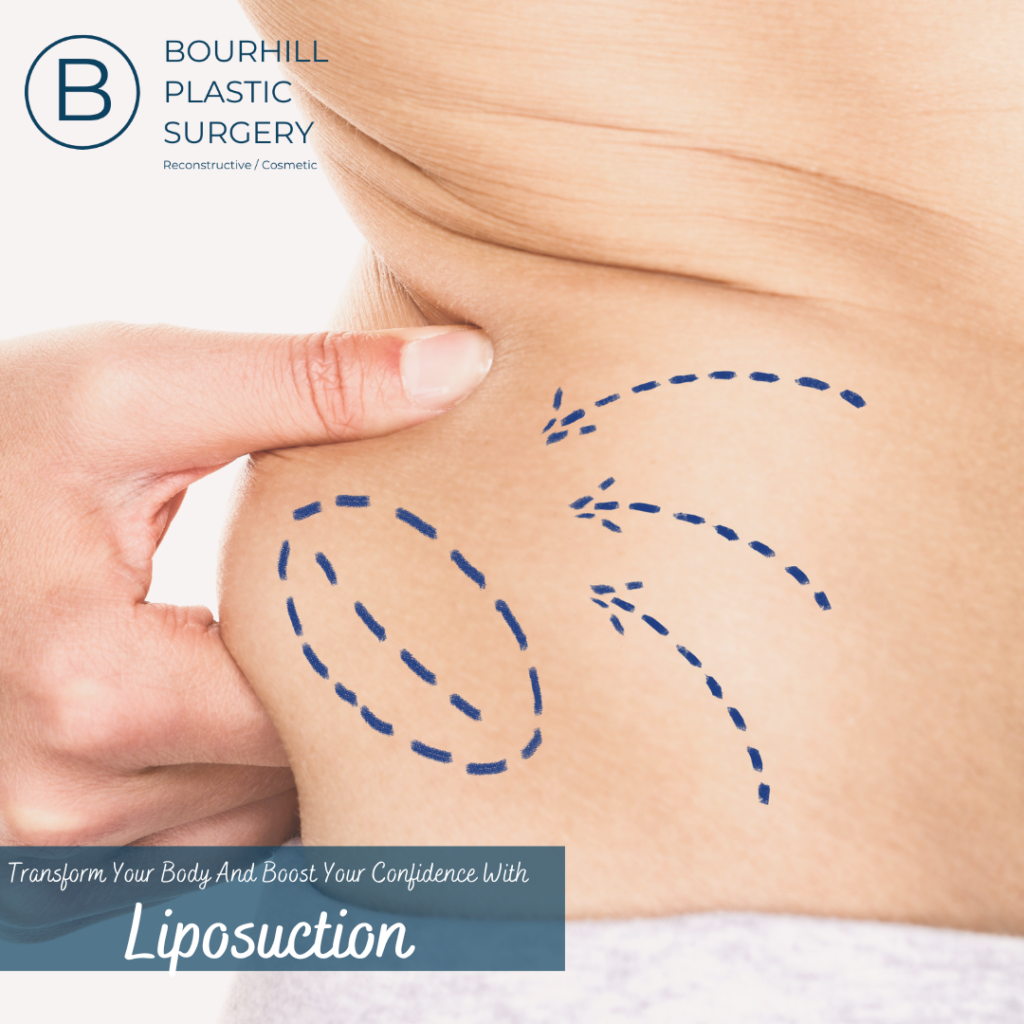 LIPOSUCTION ON LONG ISLAND